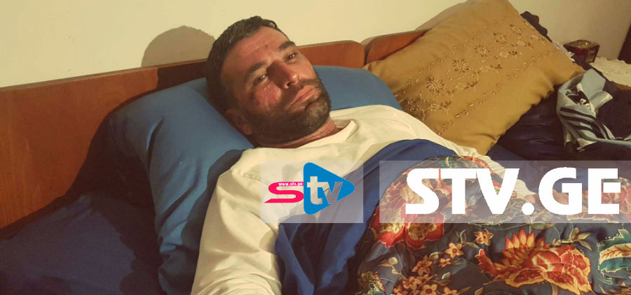 ედიშერ სიგუა მარტვილის პოლიციას ძალადობაში ადანაშაულებს